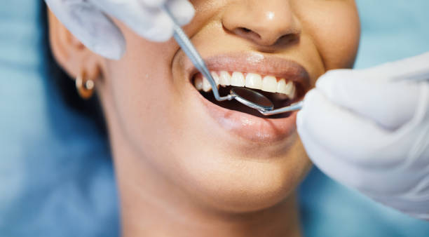 Best Emergency Treatment for Toothache in Huntsville, AL